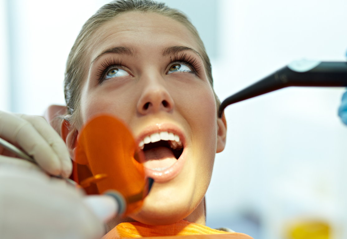 tooth-colored_fillings_Amherst_Village_dentist