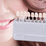teeth_whitening_Amherst_Village_dentist