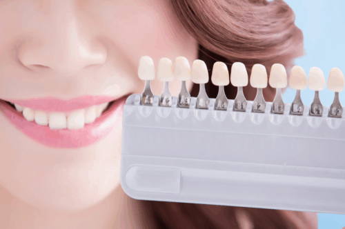 teeth_whitening_Amherst_Village_dentist
